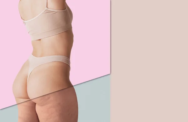 Collage Cropped Female Body Underwear Buttocks Legs Comparison Smooth Cellulite — Stock Photo, Image
