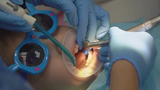 Uma menina com um dilatador oral na consulta de dentistas. — Vídeo de Stock