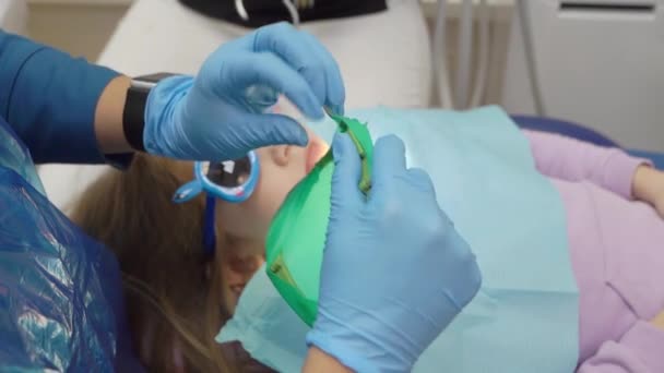Dentysta wykorzystuje Cofferdam do leczenia dziecka — Wideo stockowe