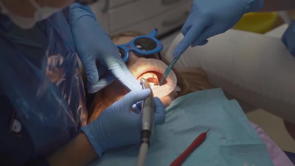 Niña con dilatador oral en la cita con el dentista. tratamiento de los dientes — Vídeo de stock