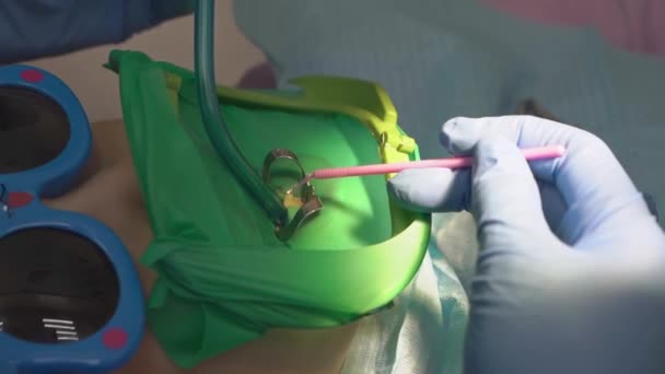 Dentiste utilise Cofferdam pour le traitement des caries et la reconstruction dentaire d'un enfant — Video