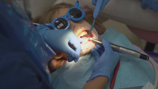 Meisje met orale dilator bij tandarts afspraak. behandeling van tanden — Stockvideo