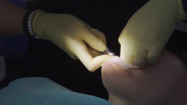 Gerçek. Dişçi hasta bir yirmilik dişi çıkardı.. 