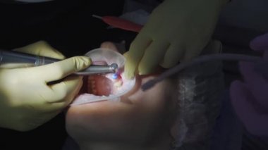 Gerçek. Dişçi hastaların dişlerini fırçalar. düzenli bakım ve önleme.