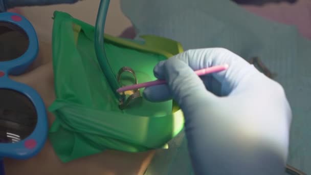 Dentiste utilise Cofferdam pour le traitement des caries et la reconstruction dentaire d'un enfant — Video