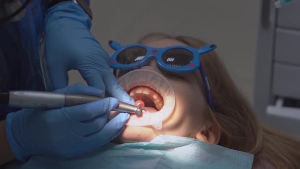 Niña con dilatador oral en la cita con el dentista. pulido de dientes — Vídeo de stock