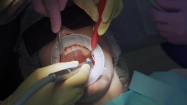 Gerçek. Diş hekimi hastaya bakıcı, diş matkabı ve dolgu malzemesi veriyor.