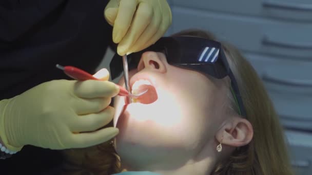 A sério. dentista examina pacientes dentes. cuidados regulares e prevenção. — Vídeo de Stock