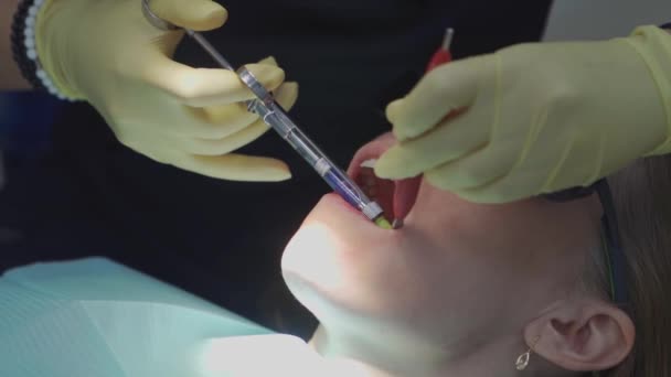 Real. dentista inyecta un anestésico en el paciente antes de la extracción dental — Vídeos de Stock