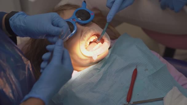 Menina com dilatador oral na consulta de dentistas. tratamento dos dentes — Vídeo de Stock