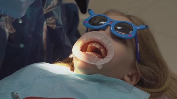 Dişçi randevusunda ağız genişleticisi olan bir kız. diş tedavisi — Stok video