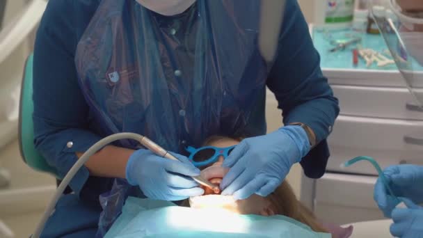 Una niña pequeña con un dilatador oral en la cita con el dentista. — Vídeo de stock