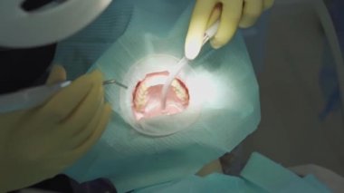 Gerçek. Dişçi hastaların dişlerini fırçalar. düzenli bakım ve önleme.