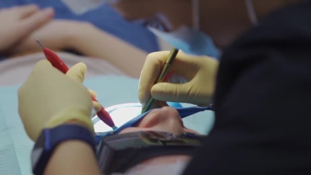 Real. dentista trata al paciente con caries, taladros de dientes e instala relleno — Vídeos de Stock