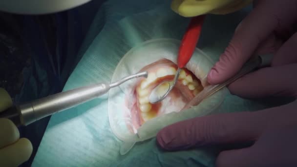 Real. dentista cepilla los dientes del paciente. atención y prevención periódicas. — Vídeos de Stock