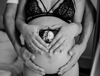 Bir erkeğin ve bir kadının elleri, çocuklarının ultrasonunu karnında taşır.