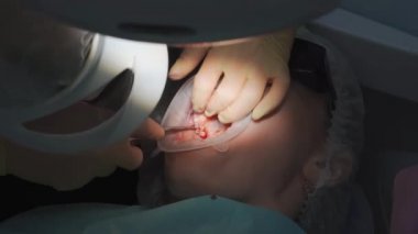 Gerçek. Dişçi hasta bir yirmilik dişi çıkardı.. 