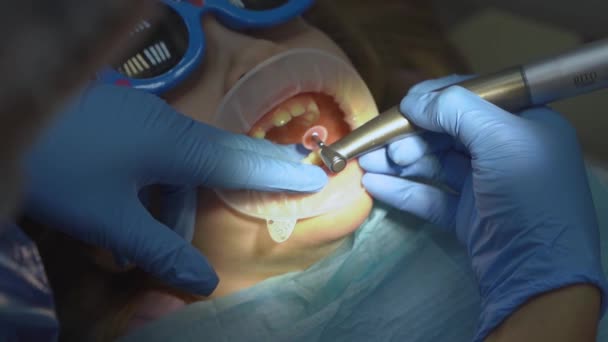 Маленька дівчинка з оральним дилататором у стоматологів. полірування зубів — стокове відео