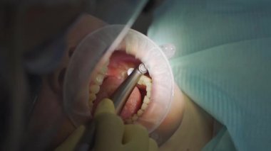 Gerçek. Diş hekimi hastaya bakıcı, diş matkabı ve dolgu malzemesi veriyor.