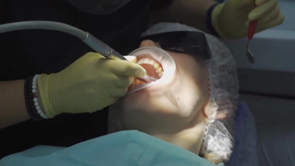 Справжній. стоматолог лікує хворого карієсом, свердлить зуб і встановлює пломбу — стокове відео