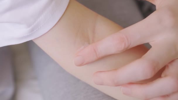 Mutter appliziert die Salbe bei Dermatitis auf die Ellbogenbeuge eines kleinen Mädchens — Stockvideo