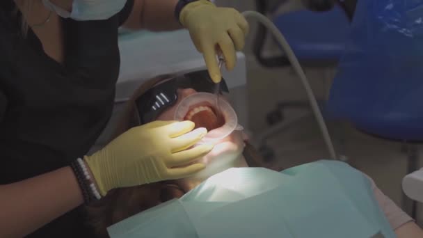 A sério. dentista escova os dentes do paciente. cuidados regulares e prevenção. — Vídeo de Stock