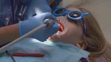Dişçi randevusunda ağız genişleticisi olan küçük bir kız. Dişlerin parlatılması