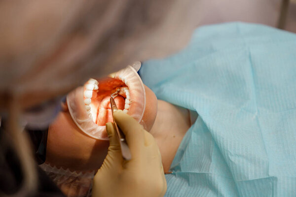Настоящее лечение. репортаж. стоматолог готовится к лечению зубов пациентов, современная профессиональная клиника. 