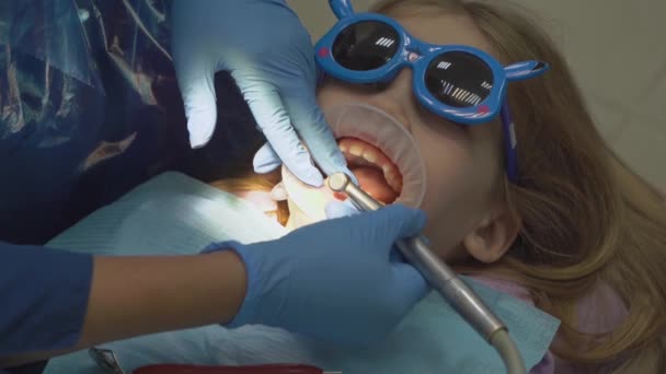 Meisje met orale dilator bij tandarts afspraak. tandenpoetsen — Stockvideo