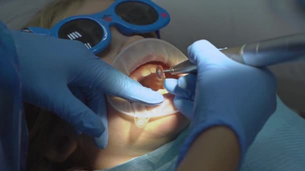 Κοριτσάκι με στοματικό διαστολέα σε ραντεβού οδοντιάτρου. στίλβωση δοντιών — Αρχείο Βίντεο
