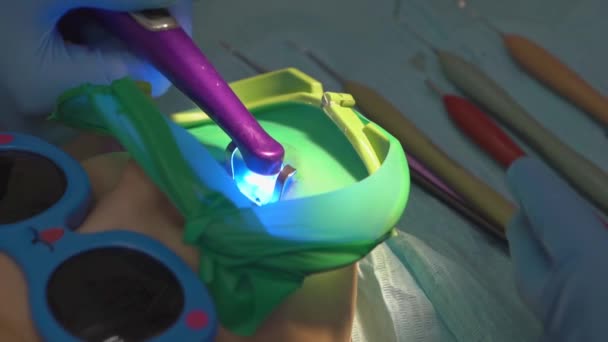 Tandläkare använder Cofferdam för behandling karies och tand rekonstruktion av ett barn — Stockvideo