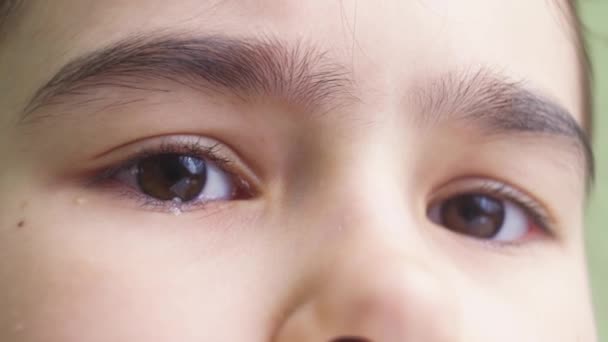 Nahaufnahme der braunen Augen eines Mädchens mit einer Träne. Allergische Tränenflüssigkeit. — Stockvideo