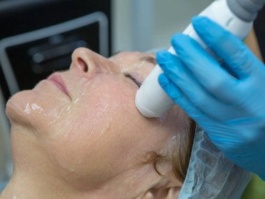 Cerrahi olmayan yüz kaldırma. SMAS ultrasonik kaldırıyor. Yenilenme süreci. Donanım kozmetolojisi. yüz plastiği. Cildiyeci doktor, beyaz bir kadını ultrasonla yüz gerdirme ameliyatı yaptı.