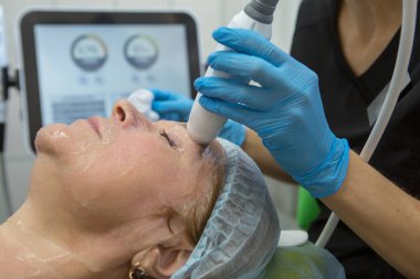 Cerrahi olmayan yüz kaldırma. SMAS ultrasonik kaldırıyor. Yenilenme süreci. Donanım kozmetolojisi. yüz plastiği. Cildiyeci doktor, beyaz bir kadını ultrasonla yüz gerdirme ameliyatı yaptı.