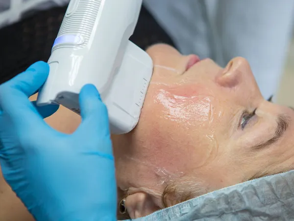 Non-surgical face lifting. SMAS lifting ultrasonic. The process of rejuvenation. Hardware cosmetology. contour face plastic. Dermatologist doctor make a Caucasian woman an ultrasound facelift