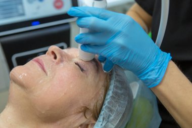 Cerrahi olmayan yüz kaldırma. SMAS ultrasonik kaldırıyor. Yenilenme süreci. Donanım kozmetolojisi. yüz plastiği. Cildiyeci doktor, beyaz bir kadını ultrasonla yüz gerdirme ameliyatı yaptı.