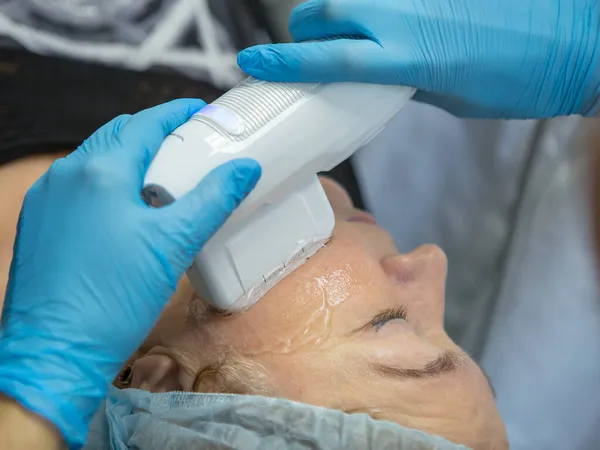 Non-surgical face lifting. SMAS lifting ultrasonic. The process of rejuvenation. Hardware cosmetology. contour face plastic. Dermatologist doctor make a Caucasian woman an ultrasound facelift