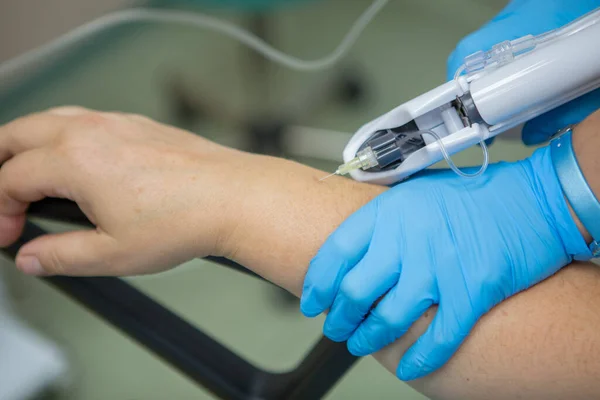 The doctor injects carbon dioxide using a needle machine into the skin of the patients hand. Carboxytherapy. Treatment and rejuvenation of the skin of the hands. Tunnel syndrome, dry skin of the