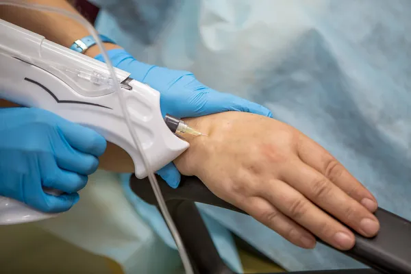 El médico inyecta dióxido de carbono utilizando una máquina de agujas en la piel de la mano de los pacientes. Carboxiterapia. Tratamiento y rejuvenecimiento de la piel de las manos. Síndrome del túnel, piel seca de la Imagen De Stock