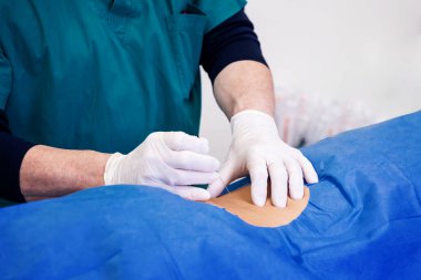 Sırt ağrısı tedavisi için ultrason rehberli infiltrasyon terapisi. Doktor, acıdan etkilenen bölgede bulunan hastaya gizlice ilaç verme pratiği yapıyor.
