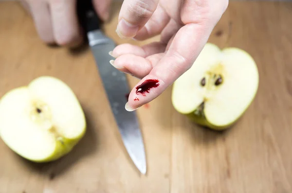 Женщина Порезала Палец Ножом Готовила Кухне Палец Кровью Несчастный Случай — стоковое фото
