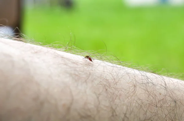 Myggan Sitter Benet Insekter Biter Sommaren Farlig Natur Kliande Kropp — Stockfoto