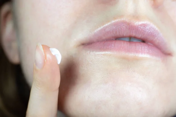 Woman Applying Face Cream Irritated Problem Skin Hands Dermatology Concept — Fotografia de Stock