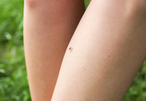 Myggan Sitter Benet Insekter Biter Sommaren Farlig Natur Kliande Kropp — Stockfoto