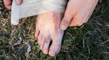 Man is putting bandage on sprained ankle. Twisted leg. Person sitting in the nature. Barefoot on the grass. Dry scratch and wound. Injured tourist. Hiking in uncomfortable shoes. Blister on toe.