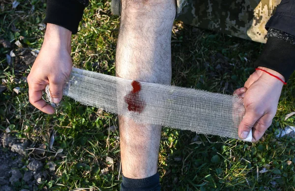 사람은 출혈로 상처에 붕대를 있어요 다리에 부상을 입었어요 관광객 감염의 — 스톡 사진