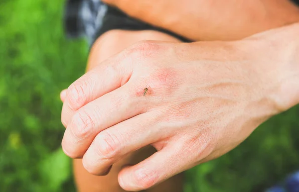 Mosquito Sitting Hand Insects Bite Summer Dangerous Nature Itchy Body — Stock Photo, Image