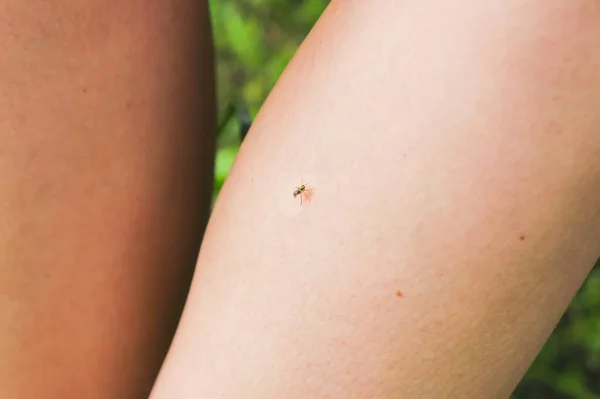 Myggan Sitter Benet Insekter Biter Sommaren Farlig Natur Kliande Kropp — Stockfoto