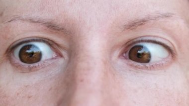 Komik Kadın Gözleri Kameraya Bakıyor, Farklı Yönlerde Dönüyor