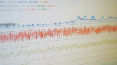 Monitor PC ekranında Candlestick Şifreleme Hareketi Çizelgesi. Büyüt